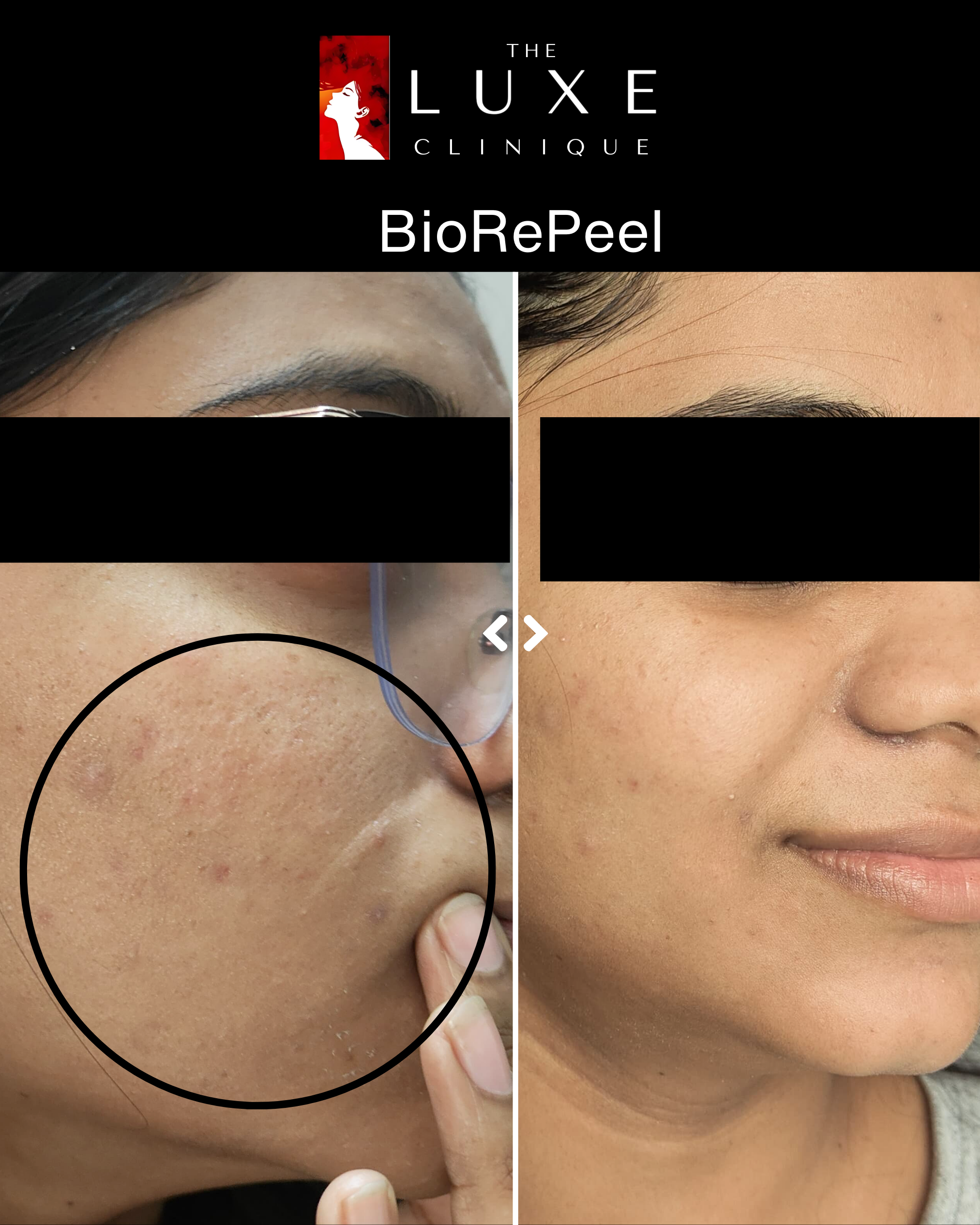 Skin Treatment 1