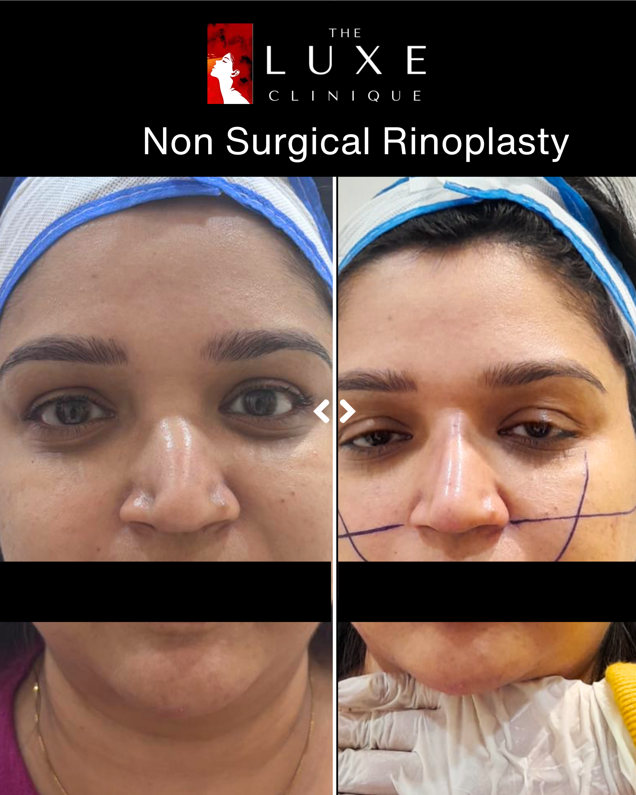 Surgery 1