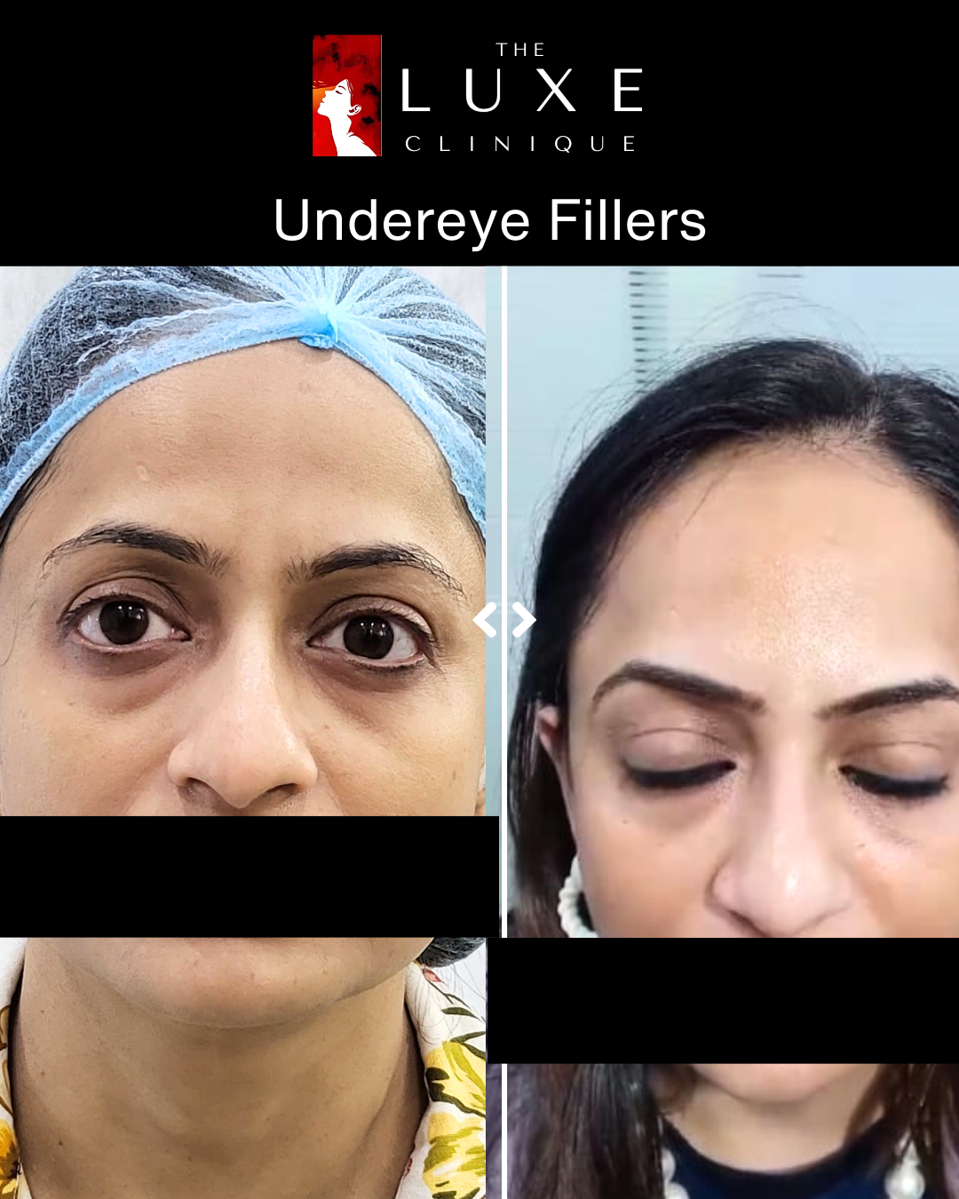 Facial Treatment 2