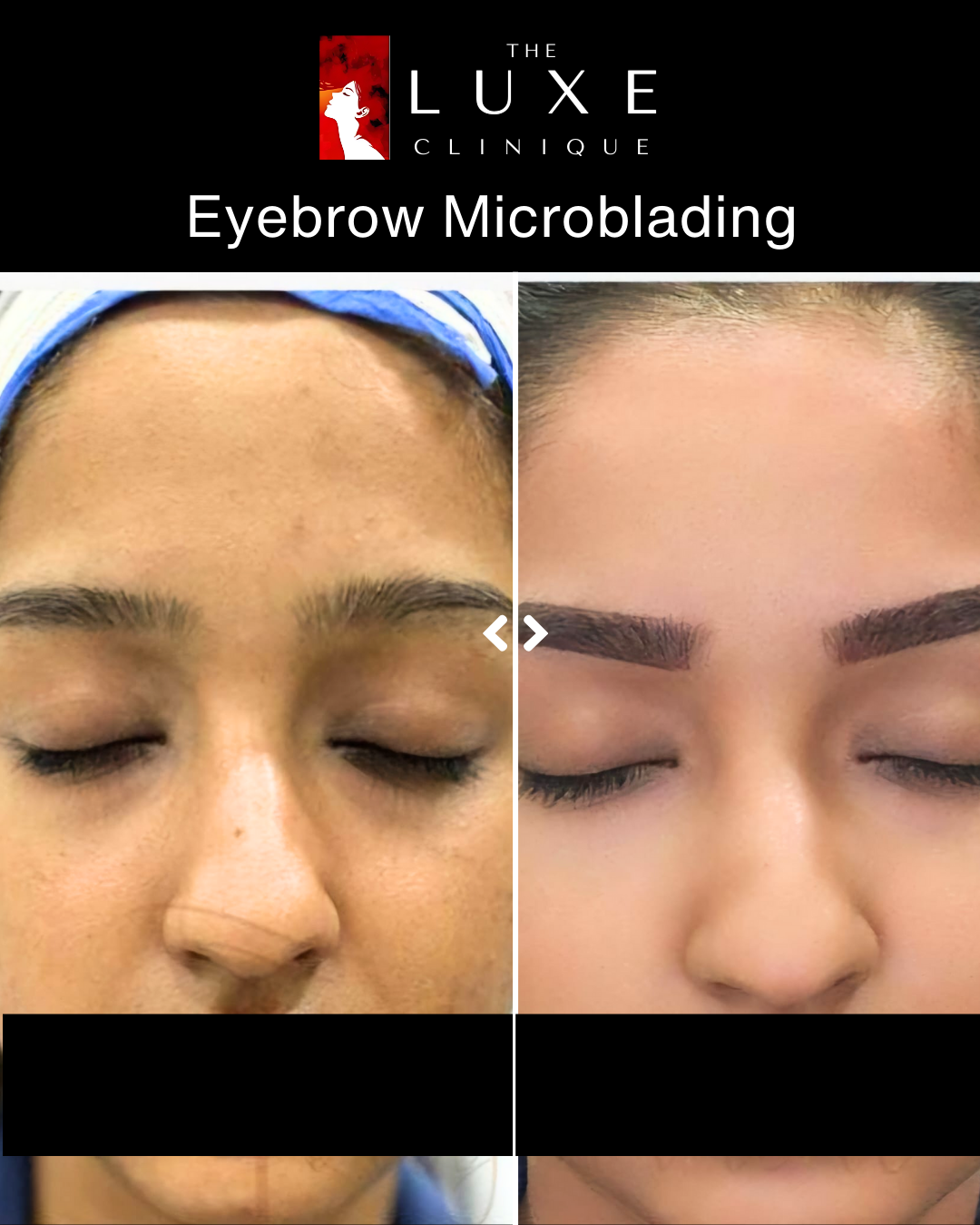 Skin Treatment 3