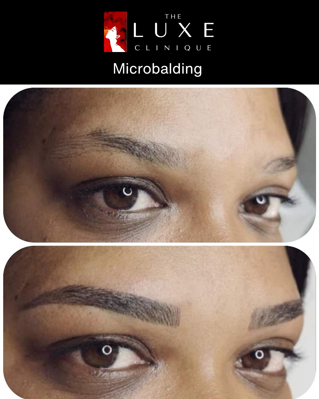 Skin Treatment 4