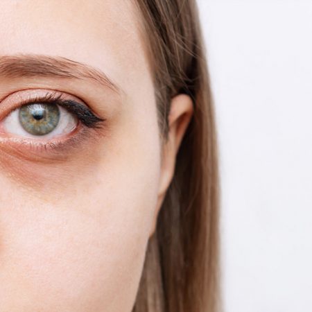 How to Stop Looking Tired