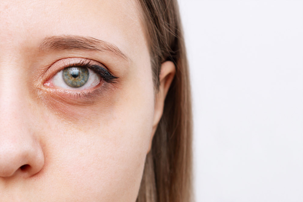 How to Stop Looking Tired